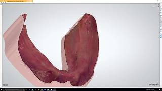 Digital denture made on intraoral scans: stability and retention!