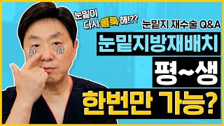 눈밑지방재배치 재발했는데 재수술 가능할까..? (재수술 해도 소용 없는 경우 있음.😱) - 의학박사 백승준