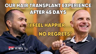 Our Experience With Hair Transplant | Marco And Stefano After 45 Days OF Hair Transplant