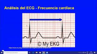 ECG normal e