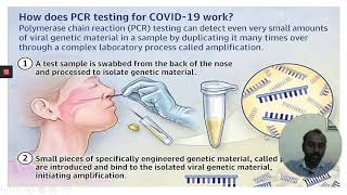 #PCR#QPCR#RT_PCR#Rapid Antibody Test and #PCR DIAGNOSIS OF CORONA VIRUS INFECTION#SEROLOGY OF COVID