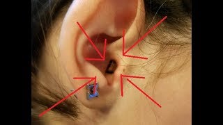 A BATTERY IN THE EAR!!!!  - September 17, 2017