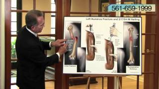 Presenting Injuries in a Trial- WPB Attorney David Glatthorn