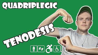 Tenodesis Grasp and Release Explained | Quadriplegic (C5,C6,C7)