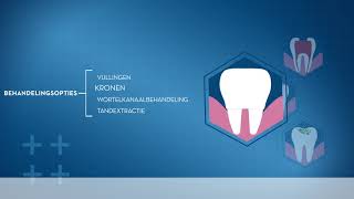 Gaatjes voorkomen met tandpasta en elektrische tandenborstel Oral-B