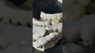 new trending shorts video tooth 🦷