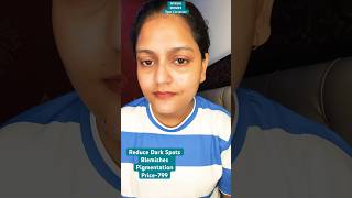 Nykaa SKINRX 10% Niacinamide Face Serum #shorts #youtubeshorts #ytshorts