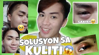 KULITI | EFFECTIVE NA GAMOT SA KULITI SA MATA!!! MABILISANG PAG GALING!😍