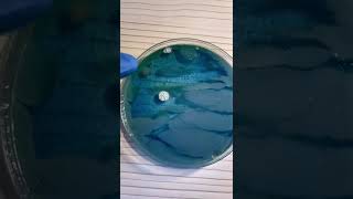 RESULTADOS DETECTIVE BACTERIA: BILLETE | YOEL LAB