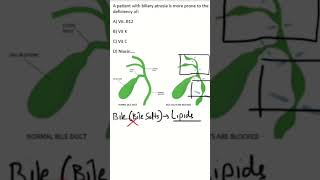 #NEETPG #BIOCHEMISTRY MCQs | Fat soluble vitamins | Biliary atresia | #fmge