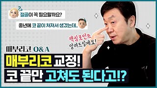 매부리코 유형별 교정방법 ㅣ 매부리코 절골? 코끝? 중년? 다 알려드릴게요!   -의학박사 백승준