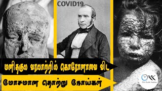 5 Diseases That Changed Human History Before Corona Attack | Covid19 | Spanish flu|  cow pox