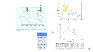 Espectroscopia IV no Diagnóstico de Câncer Gástrico