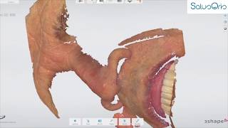 Scanning peri-oral area and the nose using an intraoral scanner