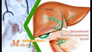 Дискинезия желчевыводящих путей. Какие симптомы? Как определить? Как лечить?