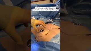 Patient Journey: Asymmetrical Breasts - Breast Augmentation