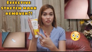 STRETCH MARK REMOVER, BODYXPERT STRETCH MARK LOTION.| PHILIPPINES