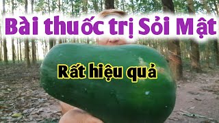 Bài thuốc trị Sỏi Mật. PHAN HẢI Vlog