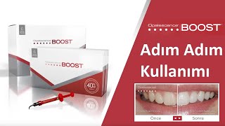 Opalescence™ Boost™ Ofis Tipi Diş Beyazlatma Adım Adım Kullanımı