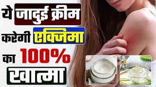 एक्जिमा का इलाज | एक्जिमा में कौन सी क्रीम लगा सकते है ? | एक्जिमा का पाएं घर बैठे इलाज