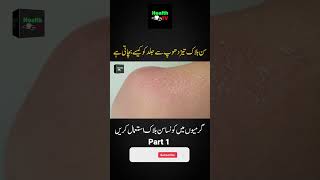 How Does Sunblock Protect Your Skin? | Best Sunblock for Summer | Part 1 Urdu / Hindi | Health TV |