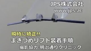 JPS巻き爪矯正器 まきづめリフト装着手順