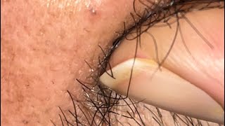 ASMR Waxing: hair ripping sound of the wax strip being removed