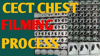 CECT CHEST FILMING PROCESS #CT CHEST CONTRAST FILMING PROCESS