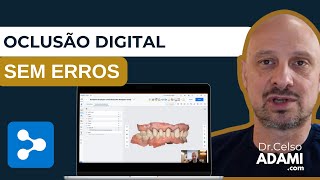 EXPLORANDO O OCCLUSION ANALYZER DO MEDIT LINK PARA PLANEJAMENTOS OCLUSAIS