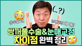 쌍꺼풀수술 할때 눈매교정 필수..? 차이점 정확히 알고 수술하세요~! (눈매교정 필요한 사람은 누구?) - 의학박사 백승준