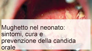 Mughetto nel neonato: sintomi, cura della candida orale