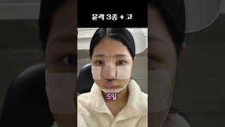 매끈매끈 둥글둥글 #plasticsurgeryinkorea