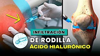 Infiltración artrosis rodilla con ácido hialurónico / Dr. julio quiroz