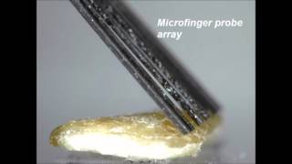 Soft SECM microfinger probe scanning a melanoma tumor