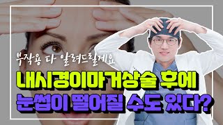 내시경이마거상술부작용! 이마거상술 후에 눈썹이 떨어질수도 있다?