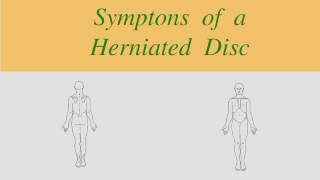 Herniated Disc Clinical Pattern