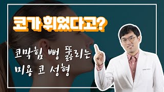 비중격만곡증 수술 고민중이라면 이영상 보고 결정해도 늦지 않아요.(feat. 코막힘으로 고생하는 630만 비염인들을 위한 헌정영상) deviated septum　鼻中隔湾曲症手術