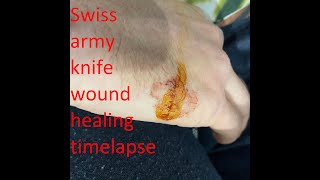 Swiss Army knife wound healing time lapse