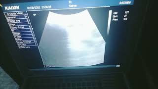 Goat ultrasound Karachi || bakri ka Hamal check krny ka asan tareeka