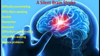 A Silent Brain Stoke