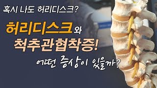 허리디스크와 척추관 협착증, 어떤증상이 있을까? (하상훈 부산본병원 대표원장)