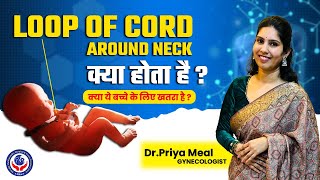 Loop of Cord क्या है ? क्या ये बच्चे के लिए खतरा होती है ?