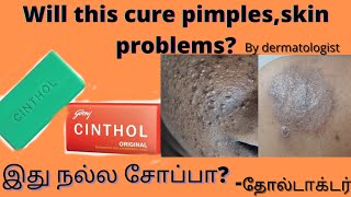 original/old cinthol soap review by dermatologist,will it cure pimples/ skin problems?