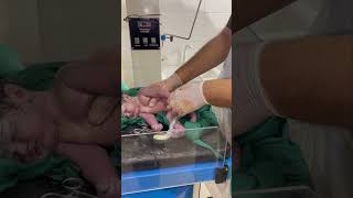 Saving a newborn #baby is not easy