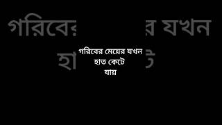 গরিবের মেয়ের যখন হাত কেটে যায় #funnyvideo #viralvideos #shots #youtubeshorts #viral #funny