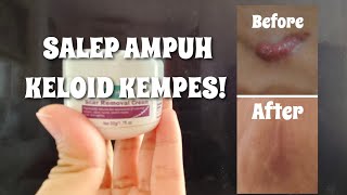 KELOID BEKAS KECELAKAAN MOTOR KEMPES PAKE SALEP INI!