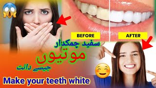 make your teeth white |  shiny teeth | beautiful teeth | healthy teeth | strong teeth|