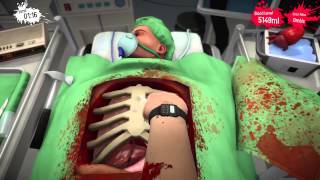 Failed Heart Surgery - Surgeon Simulator