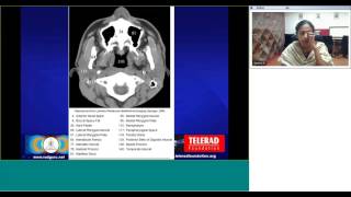 Maxillofacial CT anatomy by Dr Geetha Balasubramaniam