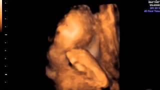 31 week ultrasound pt. 2 *3d/4d*